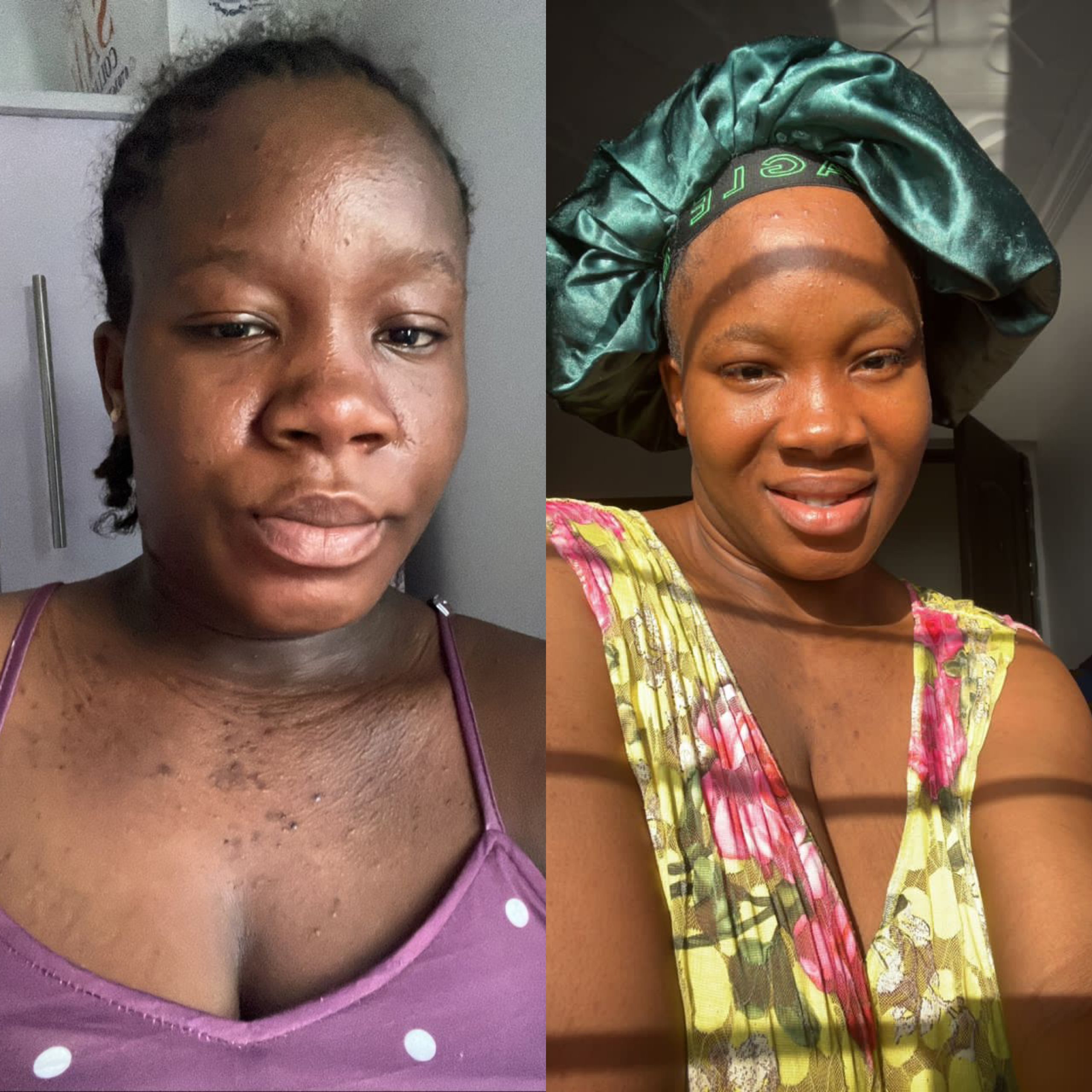 Florae customer skin journey