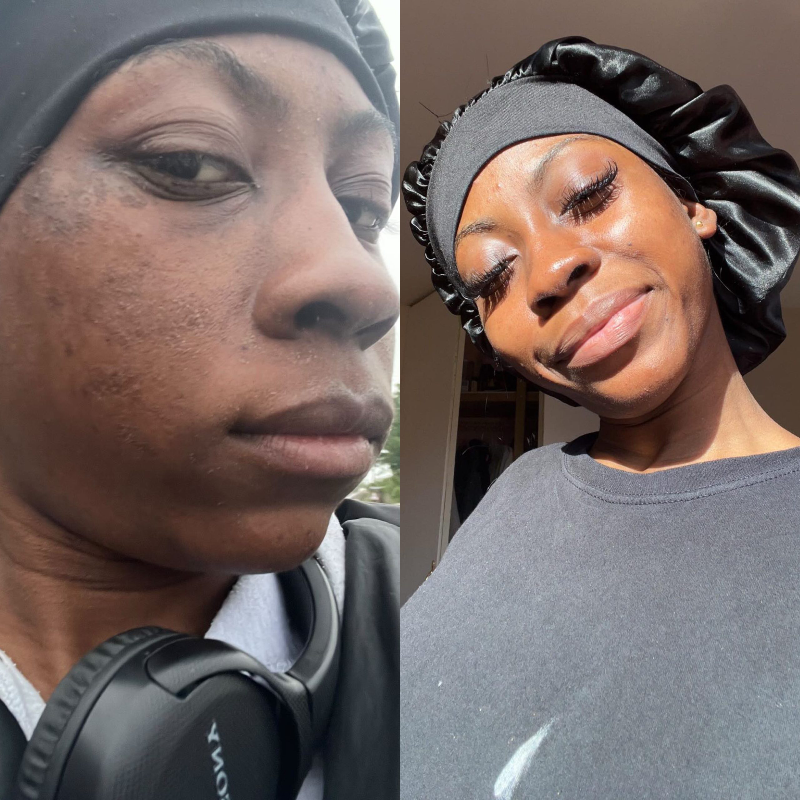 Florae skincare result